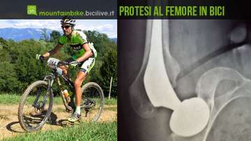 foto di davide brenna in sella alla sua mtb e della protesi al femore